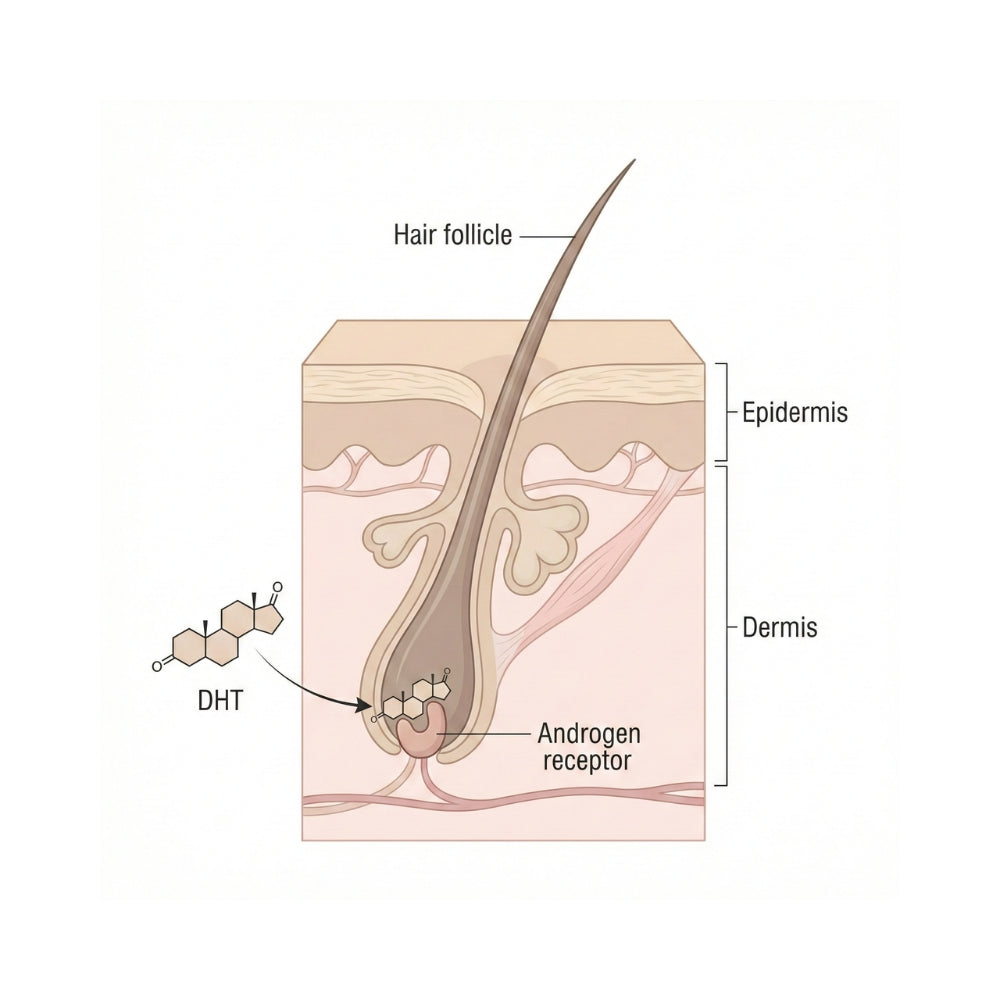 Medisch diagram van DHT dat zich bindt aan de androgeenreceptor in een haarfollikel, gerelateerd aan androgenetische haaruitval.