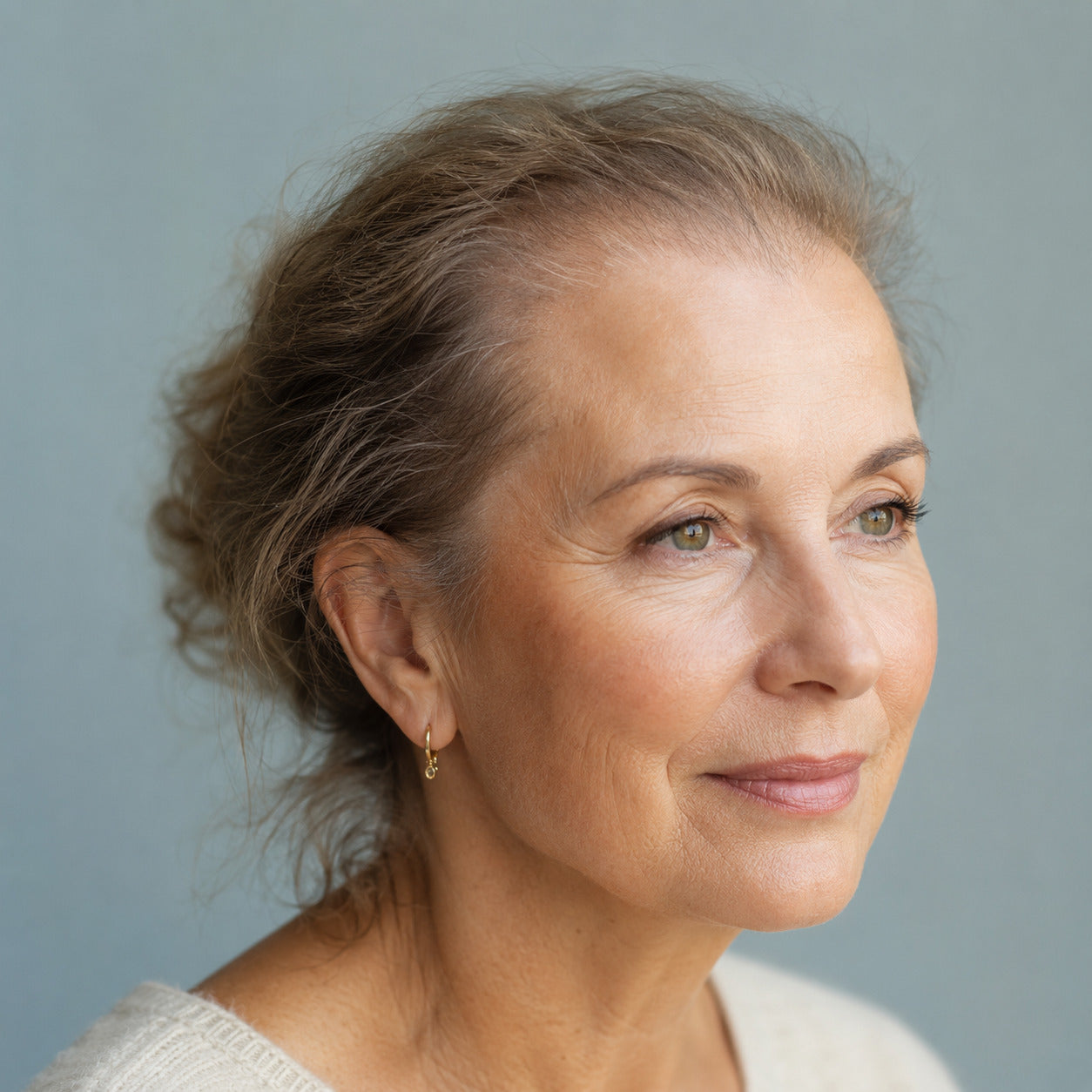 Vrouw met een subtiel terugwijkende frontotemporale haarlijn passend bij frontale fibroserende alopecie