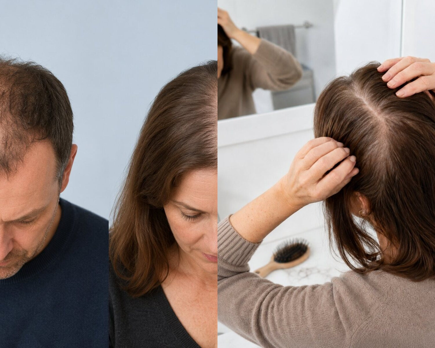 Confronto tra diradamento a schema e perdita di capelli diffusa