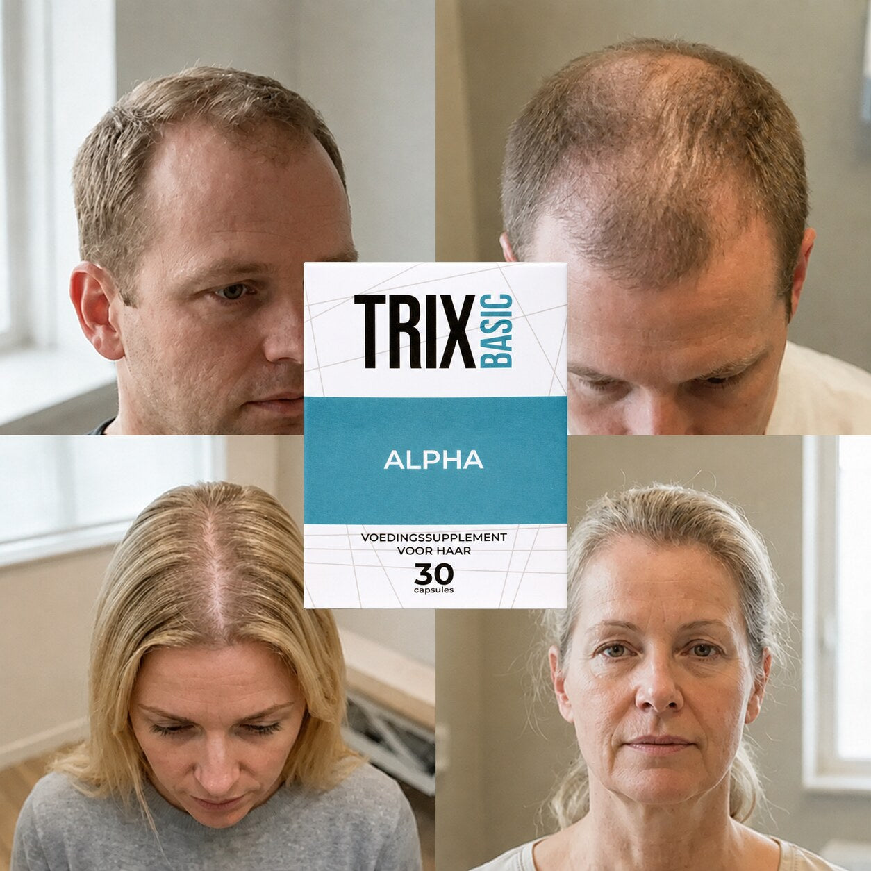 TRIX Basic Alpha bij haarpatronen passend bij alopecia androgenetica bij mannen en vrouwen.