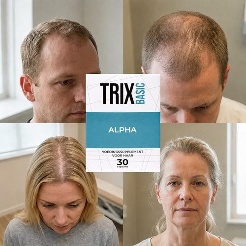 TRIX Basic Alpha per la caduta dei capelli tipica dell'alopecia androgenetica in uomini e donne.